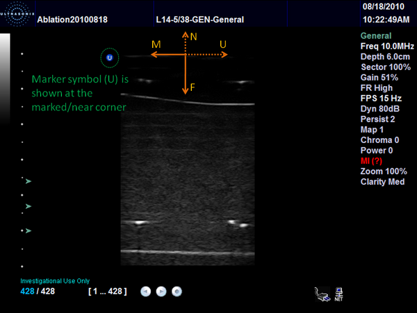 UltrasoundImageOrientationUltrasonixSw.png